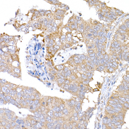 MAGED1/NRAGE Rabbit Polyclonal Antibody - Image 2