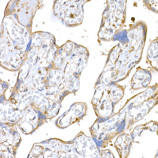 MAGED1/NRAGE Rabbit Polyclonal Antibody - Image 3