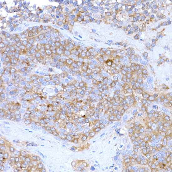 MAGED1/NRAGE Rabbit Polyclonal Antibody - Image 4