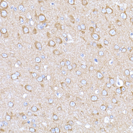 MAGED1/NRAGE Rabbit Polyclonal Antibody - Image 5