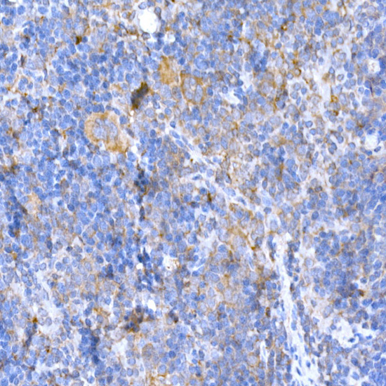 MAGED1/NRAGE Rabbit Polyclonal Antibody - Image 6