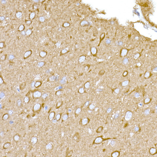MAGED1/NRAGE Rabbit Polyclonal Antibody - Image 7