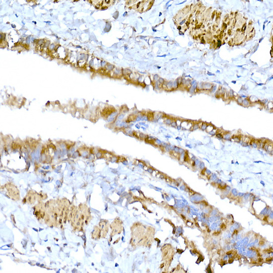 MAGED1/NRAGE Rabbit Polyclonal Antibody - Image 8