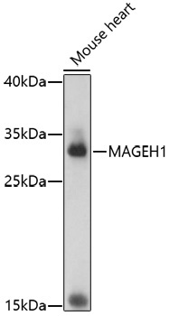 MAGEH1 Rabbit Polyclonal Antibody
