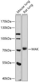MAK Rabbit Polyclonal Antibody