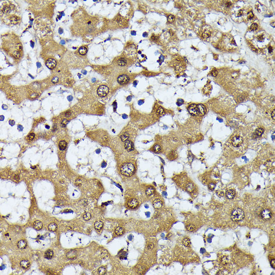 MAK Rabbit Polyclonal Antibody - Image 2