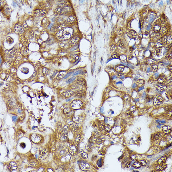 MAK Rabbit Polyclonal Antibody - Image 3