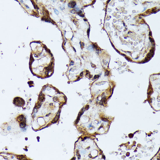 MAK Rabbit Polyclonal Antibody - Image 4