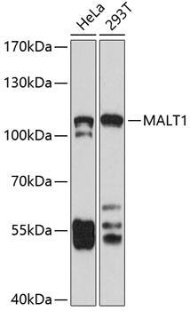 MALT1 Rabbit Polyclonal Antibody