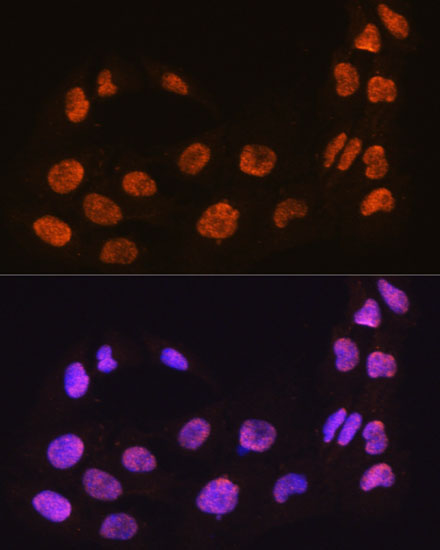 MAML2 Rabbit Polyclonal Antibody - Image 2