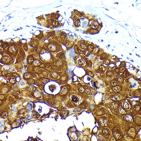 Mammaglobin A Rabbit Monoclonal Antibody - Image 2