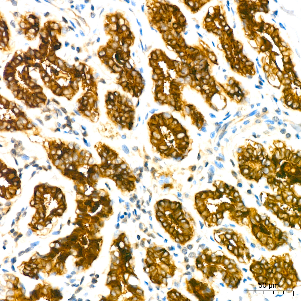 Mammaglobin A Rabbit Monoclonal Antibody - Image 3