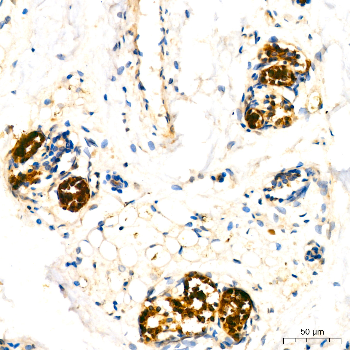 Mammaglobin A Rabbit Monoclonal Antibody - Image 4
