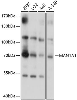 MAN1A1 Rabbit Polyclonal Antibody