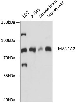 MAN1A2 Rabbit Polyclonal Antibody
