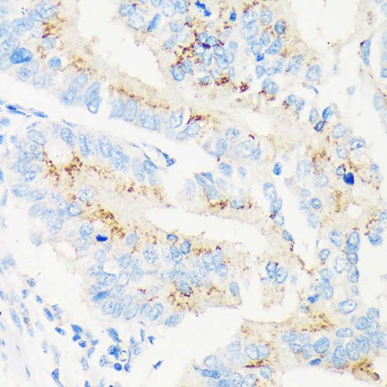 MAN1A2 Rabbit Polyclonal Antibody - Image 2