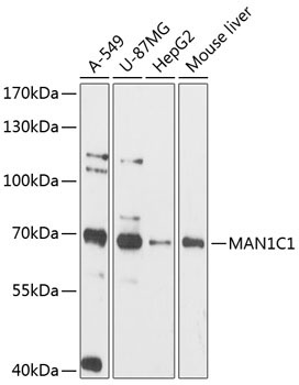 MAN1C1 Rabbit Polyclonal Antibody