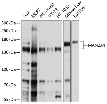 MAN2A1 Rabbit Polyclonal Antibody