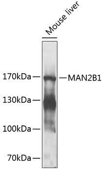 MAN2B1 Rabbit Polyclonal Antibody