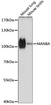 MANBA Rabbit Polyclonal Antibody