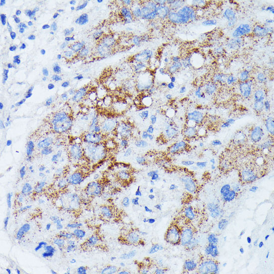 MANBA Rabbit Polyclonal Antibody - Image 2