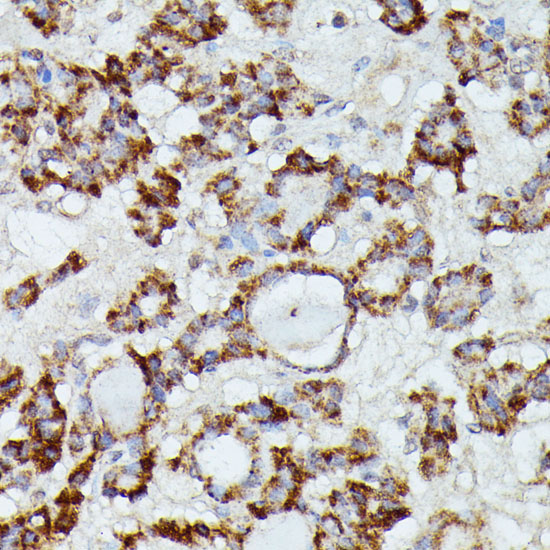 MANBA Rabbit Polyclonal Antibody - Image 3