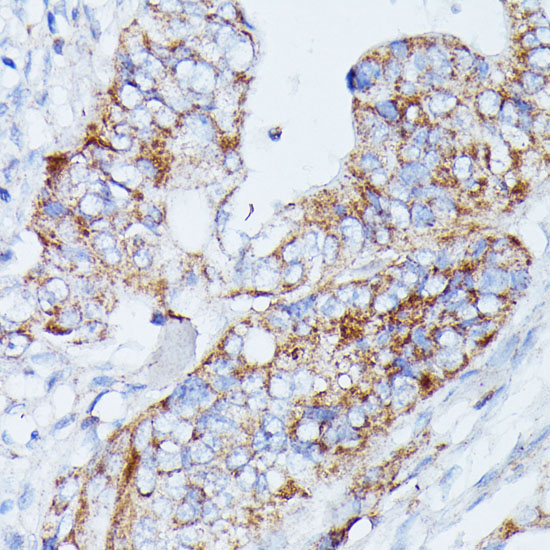 MANBA Rabbit Polyclonal Antibody - Image 4