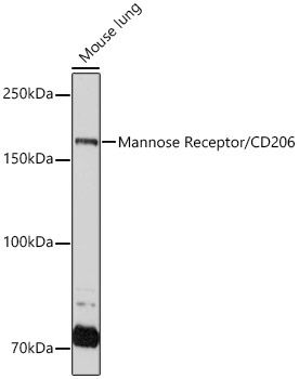 Mannose Receptor/CD206 Rabbit Monoclonal Antibody