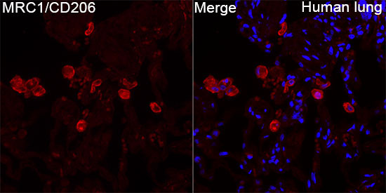 Mannose Receptor/CD206 Rabbit Polyclonal Antibody - Image 2