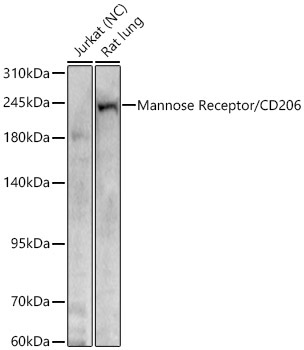 Mannose Receptor/CD206 Rabbit Polyclonal Antibody