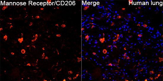 Mannose Receptor/CD206 Rabbit Polyclonal Antibody - Image 2