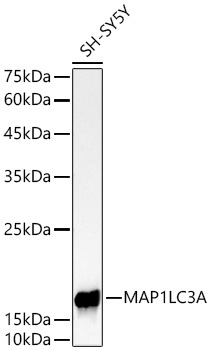 MAP1LC3A Rabbit Monoclonal Antibody - Image 2
