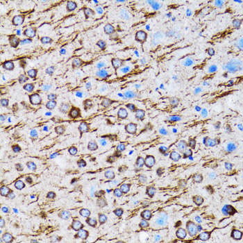 MAP1LC3A Rabbit Polyclonal Antibody - Image 2