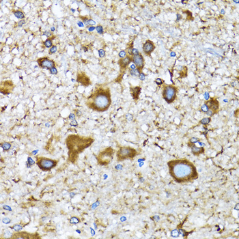 MAP1LC3A Rabbit Polyclonal Antibody - Image 3