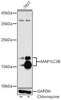MAP1LC3B Rabbit Polyclonal Antibody
