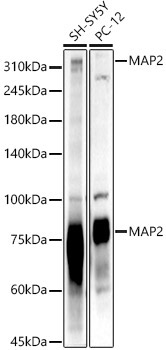 MAP2 Rabbit Polyclonal Antibody