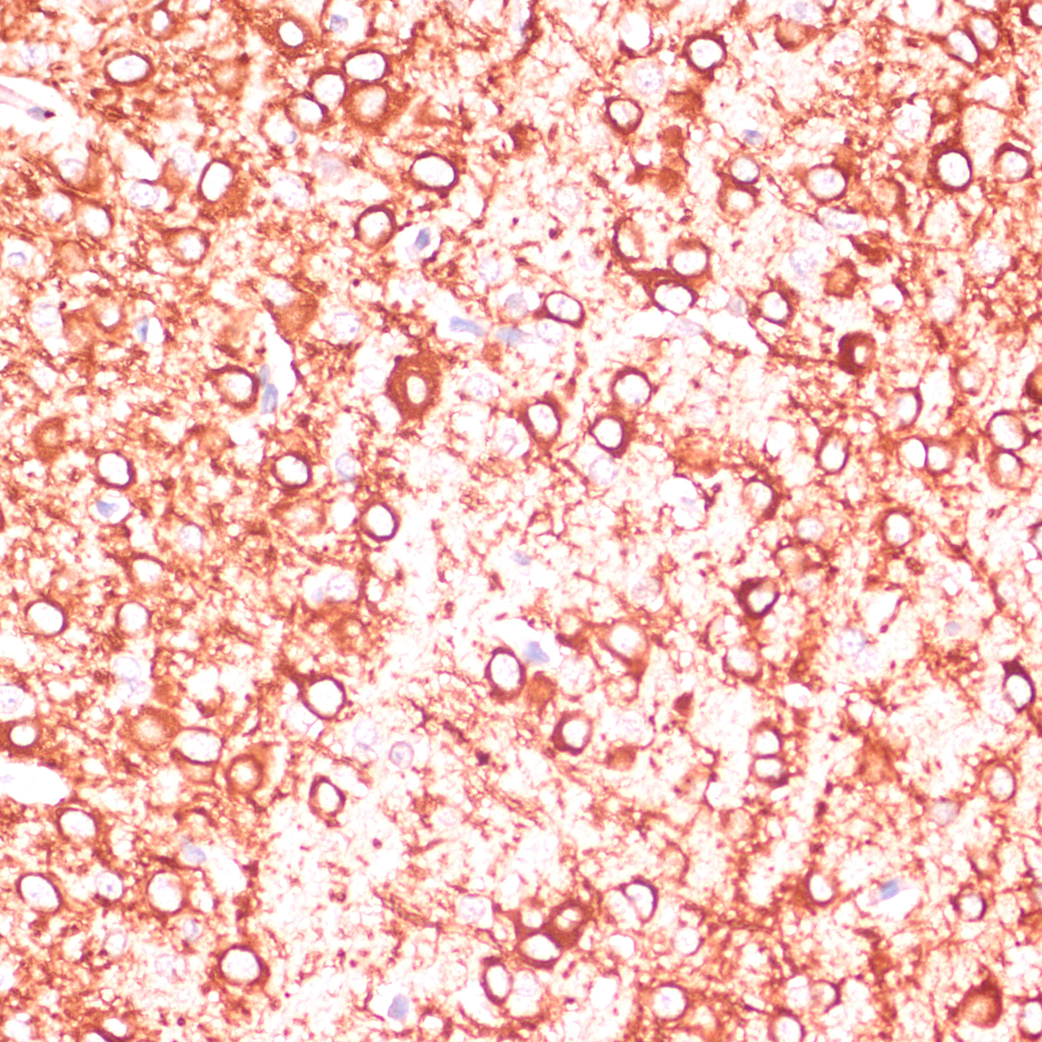 MAP2 Rabbit Polyclonal Antibody