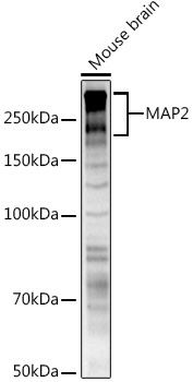 MAP2 Rabbit Polyclonal Antibody