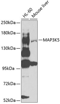 MAP3K5 Rabbit Polyclonal Antibody