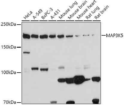 MAP3K5 Rabbit Polyclonal Antibody