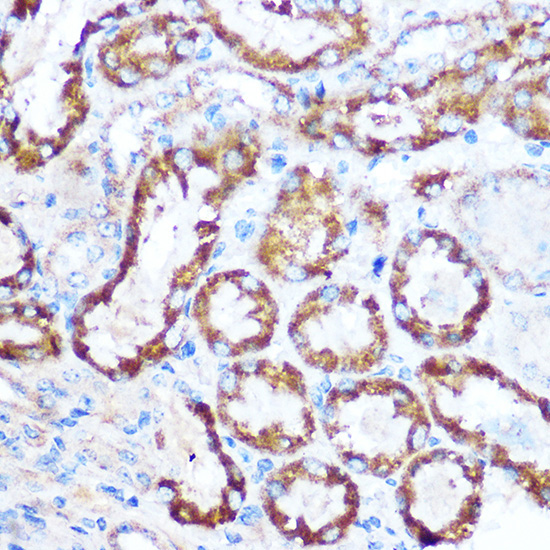 MAP4 Rabbit Polyclonal Antibody - Image 2