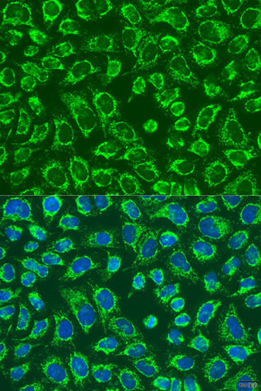 MAP4K5 Rabbit Polyclonal Antibody
