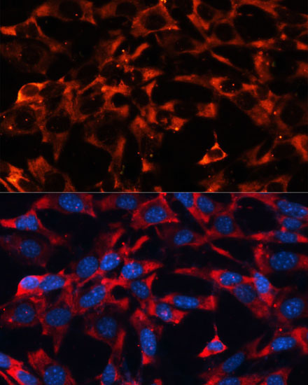 MAPK1/MAPK3 Rabbit Polyclonal Antibody - Image 2