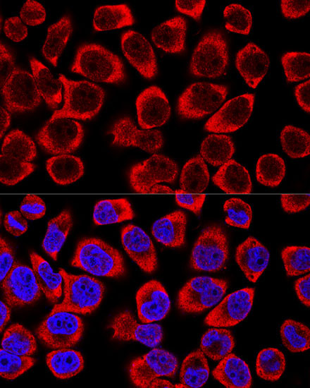 MAPK1/MAPK3 Rabbit Polyclonal Antibody - Image 3