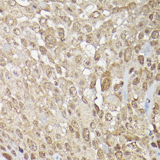 MAPK1/MAPK3 Rabbit Polyclonal Antibody - Image 2