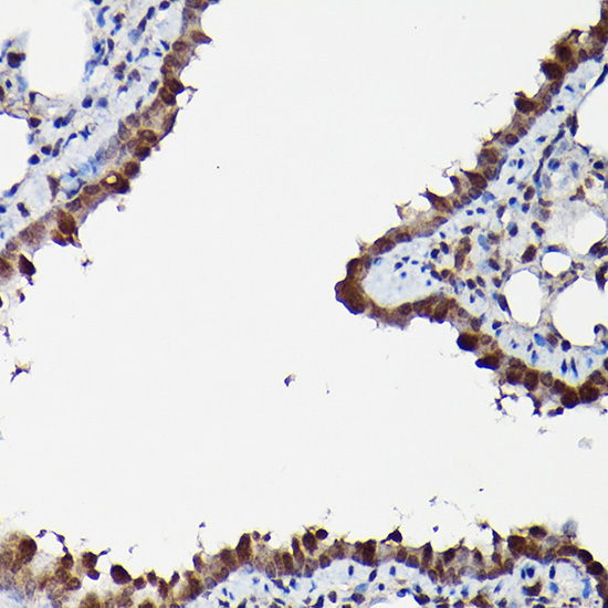 MAPK1/MAPK3 Rabbit Polyclonal Antibody - Image 4