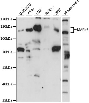 MAPK6 Rabbit Polyclonal Antibody