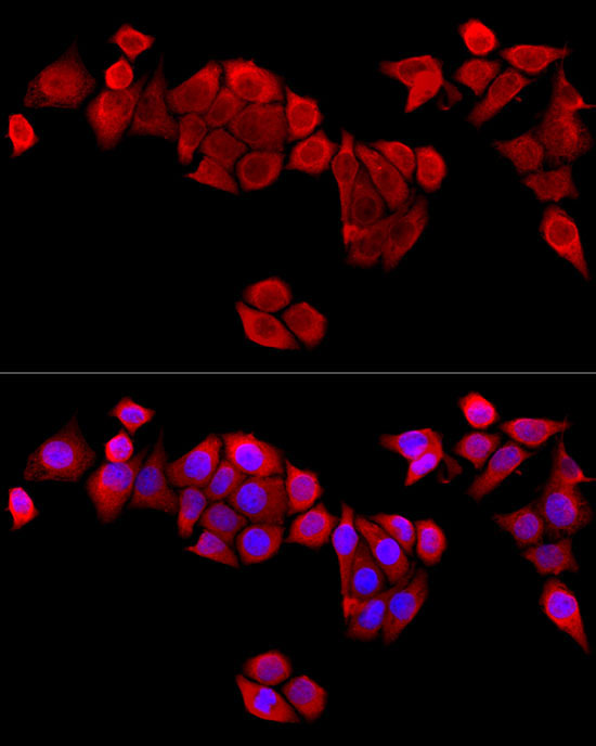 MAPRE1 Rabbit Polyclonal Antibody - Image 2