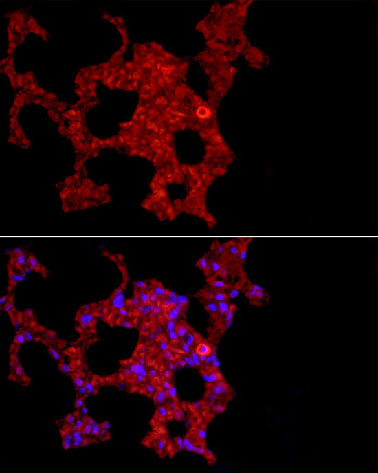MARCO Rabbit Polyclonal Antibody - Image 2