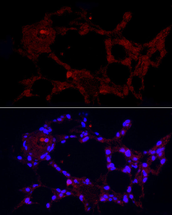 MARCO Rabbit Polyclonal Antibody - Image 3